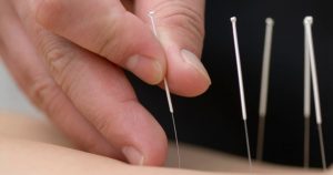 Hawthorn Center's Community Style Acupuncture @ Hawthorn Healing Arts Center